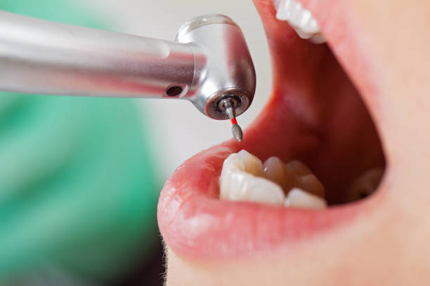 Professional Emergency Dental Service in ID